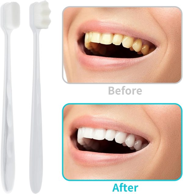 Extra Soft Micro Nano Toothbrush – Gentle on Sensitive Gums (Random Color)